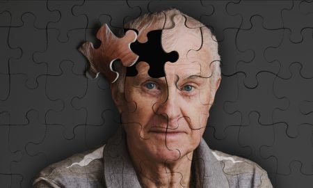 Alzheimer's disease